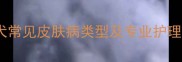 金毛犬常见皮肤病类型及专业护理指南