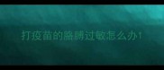 打疫苗的胳膊过敏怎么办