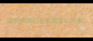 边牧洗澡后有皮屑怎么回事