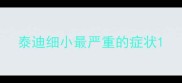 泰迪细小最严重的症状