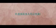 扎疫苗后多久可以洗澡