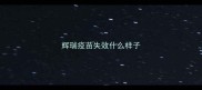 辉瑞疫苗失效什么样子