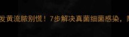猫咪眼睛发黄流脓别慌7步解决真菌细菌感染附护理指南