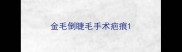 金毛倒睫毛手术疤痕